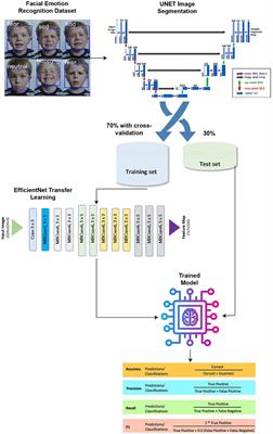 FacialNet: facial emotion recognition for mental health analysis using UNet segmentation with transfer learning model